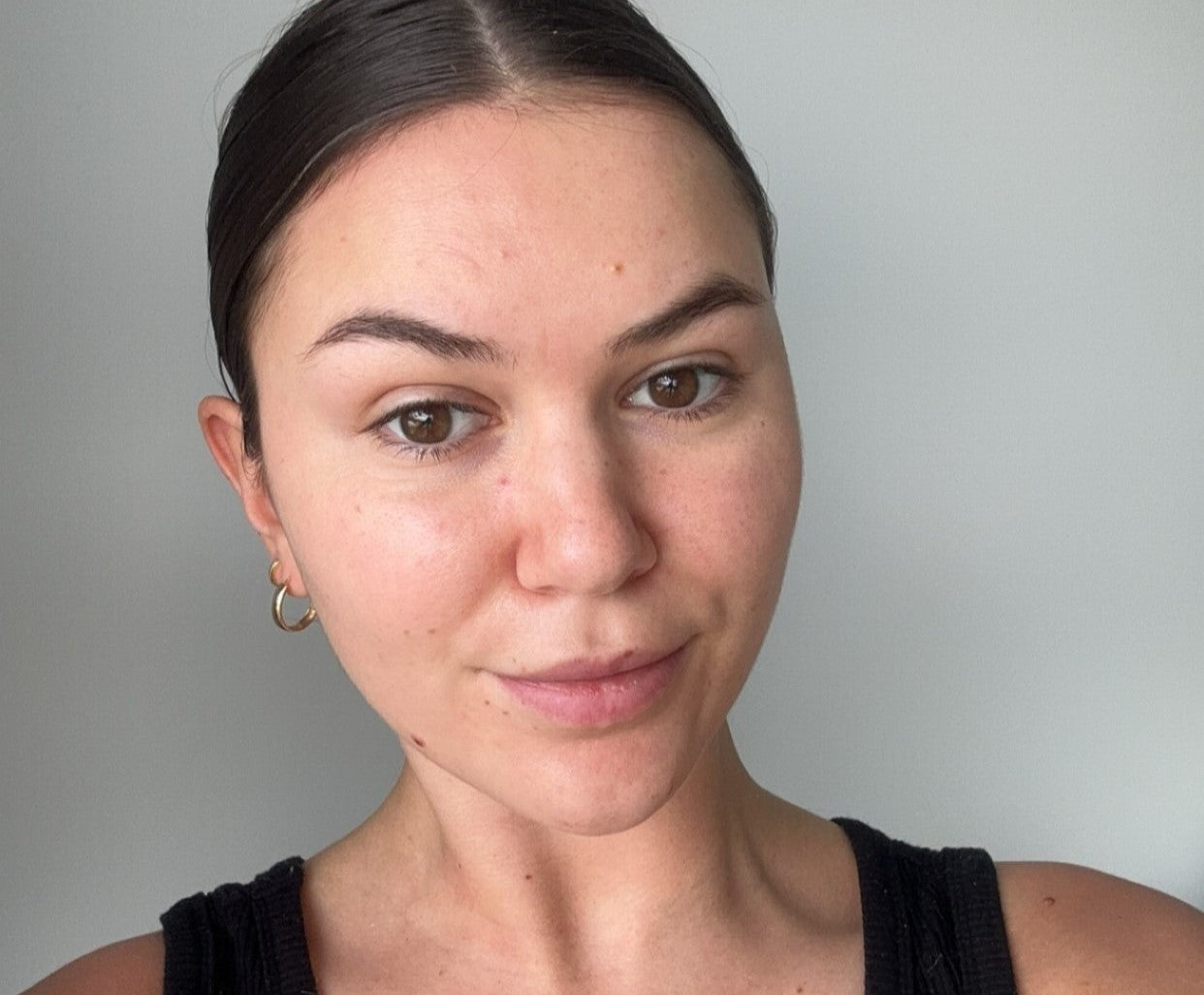 8 Weeks To Clearer Skin With Phoebe Spiller